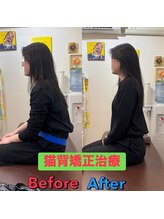 ヒデ整体院(Hide整体院)/猫背矯正骨盤矯正B/A肩こり腰痛