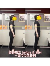 ワイルドボディ(WILD BODY)/姿勢矯正での改善例