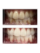 佐賀ホワイトニングラボ/