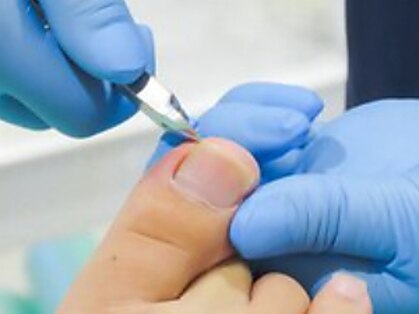 巻き爪補正店　小倉店の写真