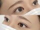 ミハル(MIHARU)の写真