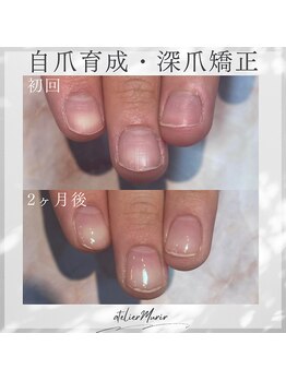 アトリエ ミュリー 代官山(atelier murir)/自爪育成・深爪矯正・巻き爪ケア