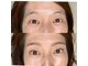 アイ ラバー(eye Lover)の写真