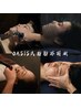 【二重顎/頬の脂肪/顔のむくみ/中顔面短縮】OASIS式脂肪分解術(小顔/美容鍼)