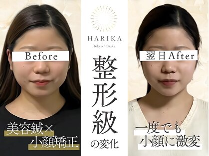 ハリカ 大阪梅田店(HARIKA)の写真
