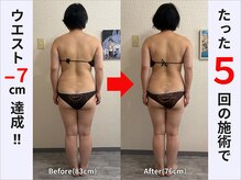 ぷりんす整体コージー(COZY)/【40代 女性】ビフォーアフター