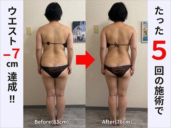 ぷりんす整体コージー(COZY)/【40代 女性】ビフォーアフター