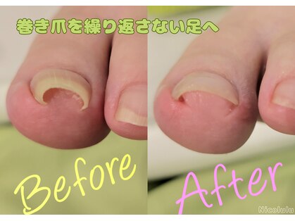 ニコルル 春日部店(Nicolulu)の写真