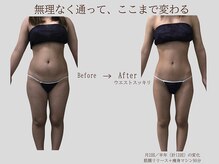 プレリー 自由が丘店/半年後の変化(前面)