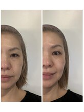 ジェーピーユキノ(jp.yukino)/クリニック級のホームケアが登場