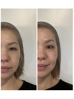 ジェーピーユキノ(jp.yukino)/クリニック級のホームケアが登場