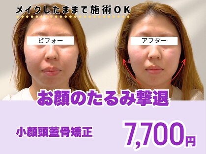ミンティー 三宮店の写真