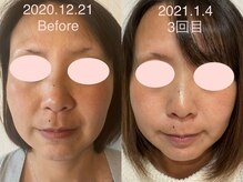 サクラ 伊勢原店(SAKURA)/同じ人に見えますか？