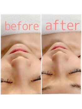 アンリール 旭川店(Anrire)/フェイシャル施術のお客様です!