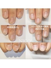 ニコプラス(NICO+)/自爪育成中