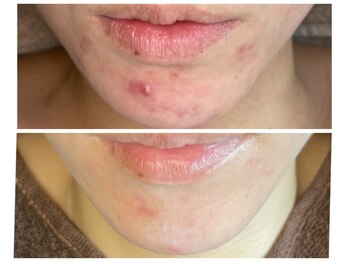 ベル(Bell)/ Before→After[1回の変化]