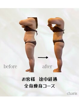 カリス(charis)/お客様途中経過☆