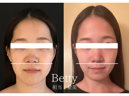 ベティ(Betty)の写真