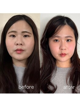 ロロサロン(roro salon)/トータル診断【before＆after】