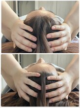 レミューズ(LES MUSES)/小顔矯正/引き上げ