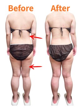 ヴィセル(VISEL)/痩身強圧リンパマッサージ