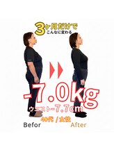 東武練馬ひだまり整骨院 鍼灸院/【ダイエット】3か月で-7.0キロ