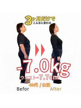 東武練馬ひだまり整骨院 鍼灸院/【ダイエット】3か月で-7.0キロ