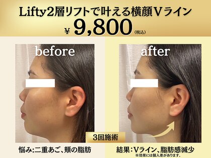 イーラボ 池袋店(e-LABO)の写真