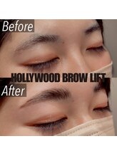 オルト(Orto)/ハリウッドブロウリフト