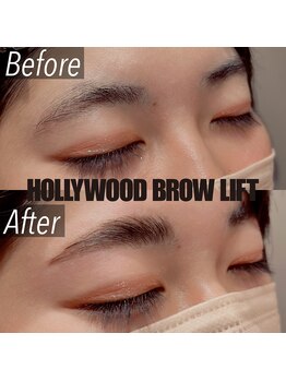 オルト(Orto)/ハリウッドブロウリフト