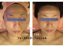 ナチュール(NaTuRu)/フォースカッターフェイシャル