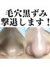 毛穴でお悩みの方必見！効果実感話題の【毛穴洗浄】