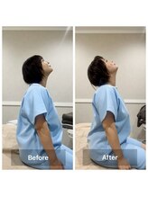 ヴィーライン 恵比寿本院(VeLine)/ボディ施術のBefore After