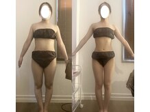 アイボディ(iBDY)の雰囲気（ハイパーナイフ全身コース＋お食事管理で健康的にサイズダウン！）