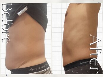 オームの森 北浜/内臓脂肪にもアプローチ!