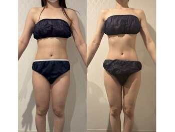 ワイグレイス(Y.GRACE)/ヴィーナスディーバ（4D痩身）