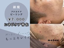 モビー 天王寺店(mobee)の雰囲気（メンズ脱毛/メンズフェイシャル/都度払い）