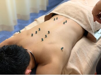 あき鍼灸整骨院/鍼灸施術