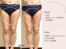 ヨサパーク すずのね(YOSA PARK)/美脚コースでむくみスッキリ！