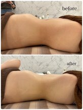 リノレア(Lino_Lea)/【body大人気メニュー】