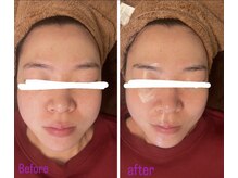 マオ(mao)/☆1回Before→after☆