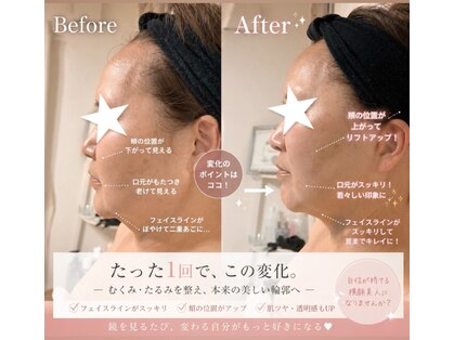 カエラ(Kaela)の写真