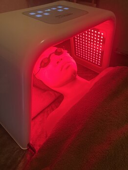 サロンアズ(salon AZU)の写真/★即日リフトUP★【オメガPDT】でキュッと小顔を即実感!ハリツヤの感動大人肌へ〇*瀬戸