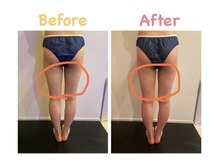 クレビア 麻布十番(CREBIA)/短期間で下半身スッキリ！！