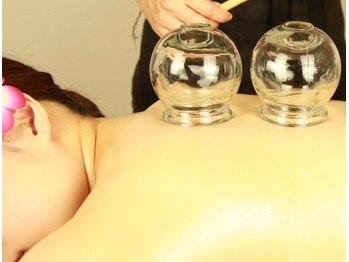 東方健美堂 かっさ・リラクゼーションサロン/■疲れ改善・免疫力UPカッピング