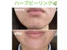 ◎導入！剥離しないハーブピーリング♪すぐわかる効果♪
