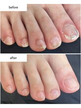 ケアプラス(care plus)/フットネイルケア