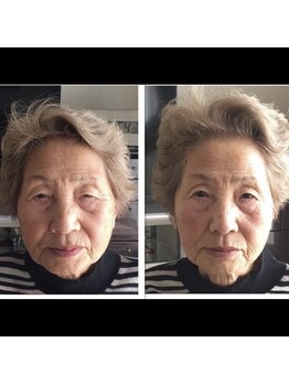 リアン(Re:an)/美容鍼灸