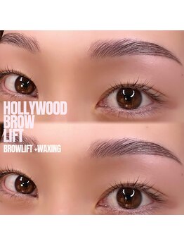 ヴィフ(Vif)/ハリウッドブロウリフト