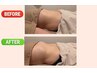 【7/24・30限定】腸もみ45分　腸の大掃除！翌日のお通じスッキリ！